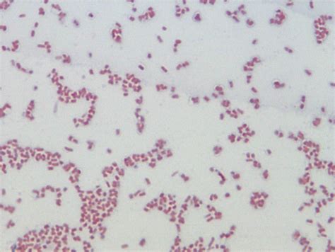 Enterobacter Aerogenes .